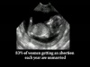 Abortion Statistics